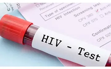 آزمایش ایدز چگونه است و چه زمانی پاسخ آن مشخص می شود؟