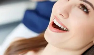 با این روش های آسان دندان سفید تر و ظاهری مناسب تر داشته باشید