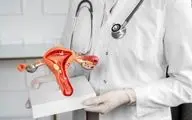 نکات مهم قبل از مراجعه به متخصص زنان!