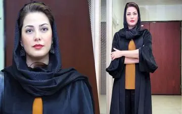 تصویر لو رفته از طناز طباطبایی قبل از عمل زیبایی / شوکه می‌شوید!