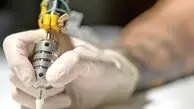  بهترین شیوه برای پاک کردن تاتو/بزرگ‌ترین اشتباه آرایشگرها در پاک کردن تاتو