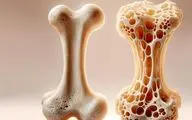 دو ماده غذایی کلیدی برای سلامت استخوان‌ها