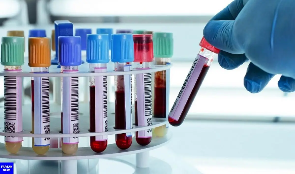 شش موردی که دکتر درباره آزمایش خون به شما نمی گوید