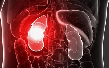 بیماری کلیوی| علائم هشدار دهنده مشکلات کلیوی را بشناسید