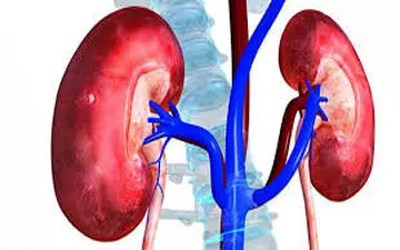 
راهکاری برای پیشگیری از عود سنگ کلیه