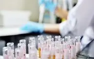 دستگاه تشخیص فوری ویروس کرونا در چین اختراع شد