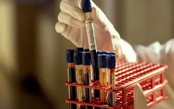 چرا تری‌گلیسرید، خطرناک‌ترین چربی خون است؟