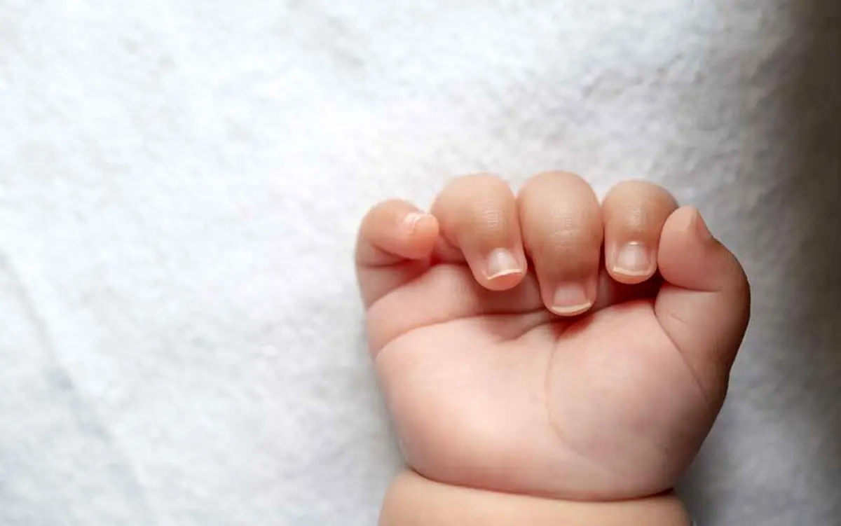 تصاویر نوزاد عجیبی که هالک به دنیا آمد! | دست و بالاتنه ترسناک نوزاد را ببینید