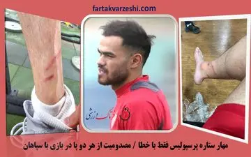 مهار ستاره پرسپولیس فقط با خطا / مصدومیت از هر دو پا در بازی با سپاهان+عکس
