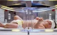 زردی تا چه حد میتواند برای سلامت نوزاد خطرناک باشد؟