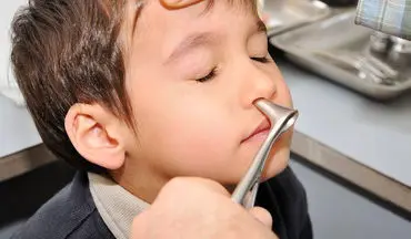 در صورت وجود جسم خارجی در گوش یا بینی کودکان چه باید کرد؟