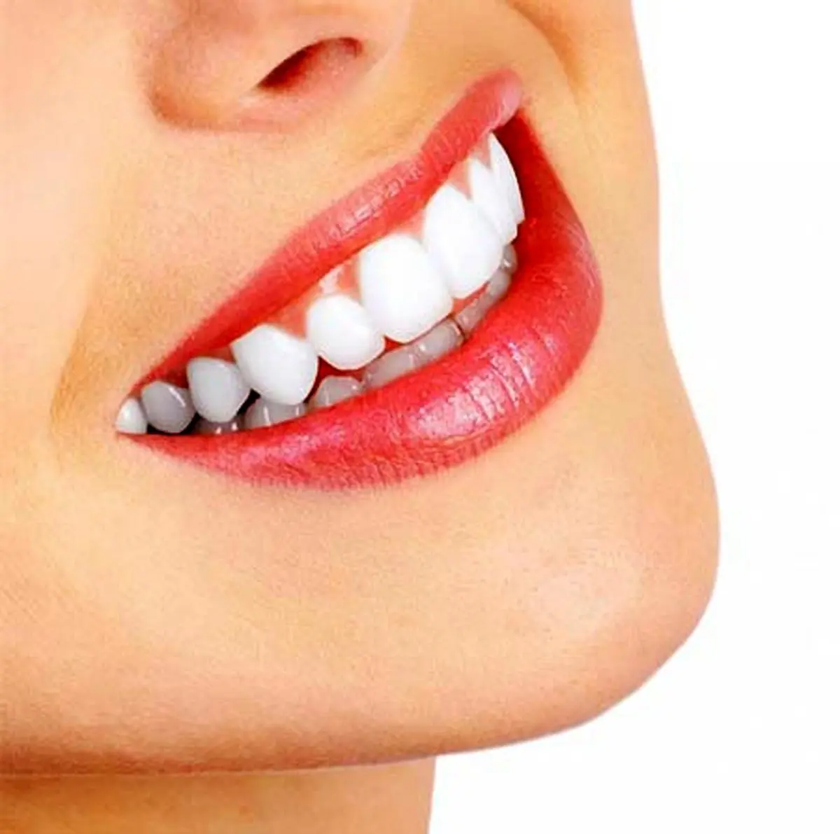 برطرف کردن جرم دندان با روش‌های طبیعی 