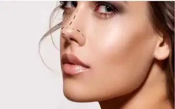 بدون جراحی بینیت رو لیفت کن! | روش‌های کاربردی و آسان لیفت بینی | کوچک کردن بینی در خانه و بدون هزینه