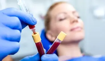 «ماسک قاعدگی» ترند عجیب شبکه‌های اجتماعی: آیا خون پریود واقعاً پوست را ترمیم می‌کند؟