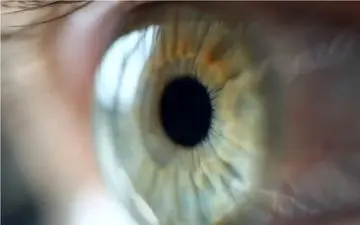 سرماخوردگی چشمی چیست؟ + هشدار مهم پزشکی
