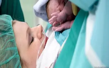 چطوری جای زخم های سزارین را درمان کنیم ؟ | از بین بردن کامل جای زخم سزارین امکان پذیر است؟