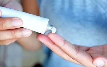 قارچ پوستی چیست؟ علائم، علل و راه های درمان سریع آن


