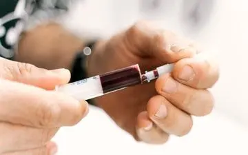 تشخیص آلزایمر با آزمایش خون