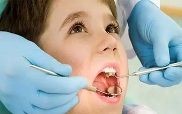 دندان‌دردهای ضربان‌دار و مداوم را جدی بگیرید