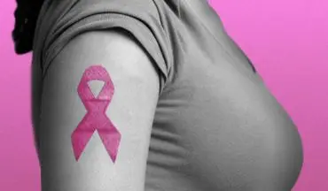 تست‌های غربالگری سرطان سینه: چه زمانی و چگونه انجام دهیم؟