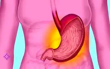 چرا سوزش سر دل داریم + راهکارهای درمان