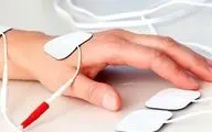 فعالیت ۹ هزار فیزیوتراپیست در کشور/ بسیاری از خدمات رایج تحت پوشش بیمه‌ها نیست