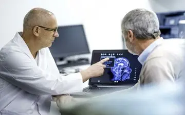 مراحل پیشرفت بیماری آلزایمر