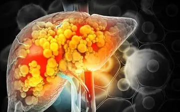 دشمنان پنهان کبد را بشناسید| چند راه‌حل‌های سالم کاربردی

