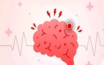 برای جلوگیری از سکته مغزی/ ۵ عاملی که نباید نادیده گرفته شوند!