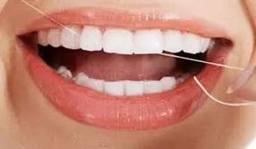 آیا  نخ دندان  در سلامت دندانها تاثیری دارد؟