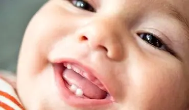 دندان‌ این نوزادان زودتر درمی‌آید