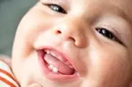 دندان‌ این نوزادان زودتر درمی‌آید