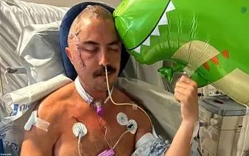 حمله وحشیانه تمساح به یک شناگر/ جمجمه مرد جوان له شد + عکس