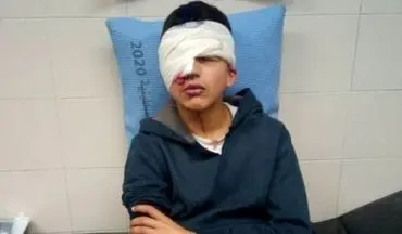 نوجوان فلسطینی به ضرب گلوله صهیونیست‌ها یک چشم خود را از دست داد