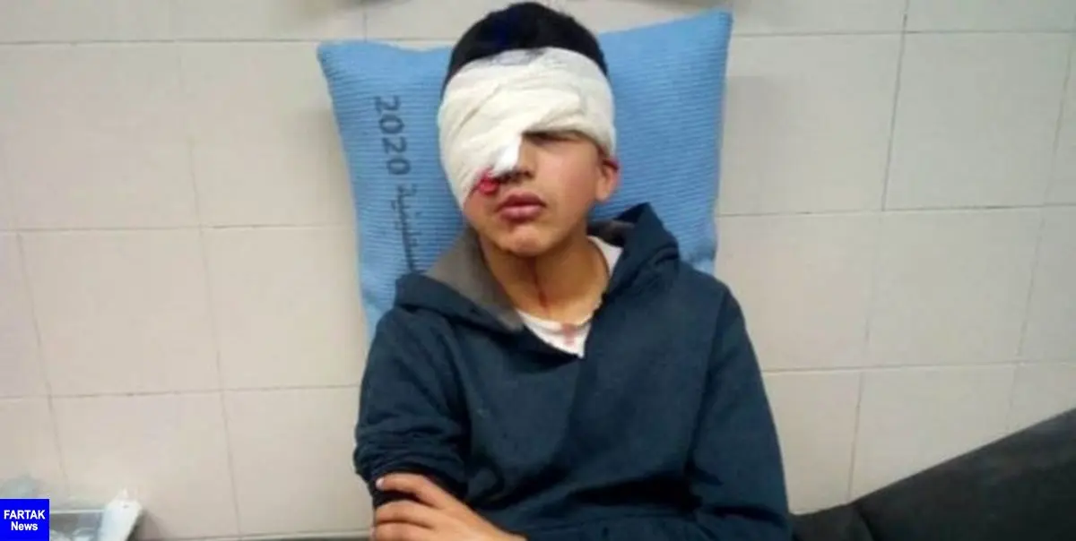 نوجوان فلسطینی به ضرب گلوله صهیونیست‌ها یک چشم خود را از دست داد