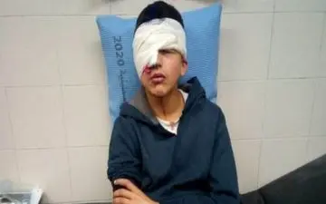 نوجوان فلسطینی به ضرب گلوله صهیونیست‌ها یک چشم خود را از دست داد