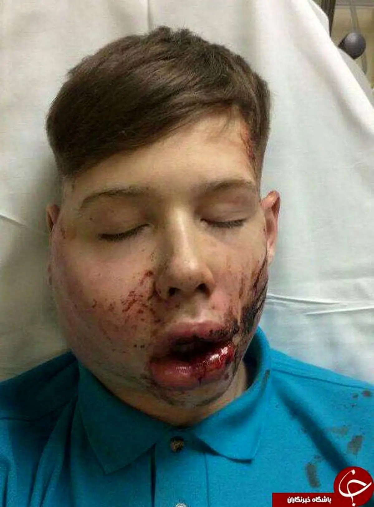 تصاویری هولناک از ضرب و شتم پسر نوجوان تا سر حد مرگ (+ ۱۸) 