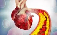 شیر باعث چربی خون می شود؟