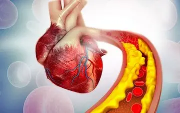 شیر باعث چربی خون می شود؟