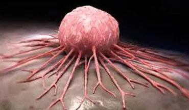 هورمون‌های استرس سلول‌های خفته سرطانی را بیدار می‌کنند