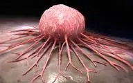 هورمون‌های استرس سلول‌های خفته سرطانی را بیدار می‌کنند