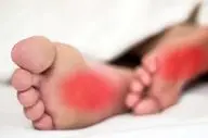 درمان خانگی داغی کف پا با یک ترفند ساده و کم‌هزینه