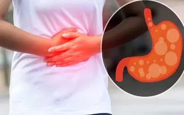 درمان فوری نفخ و باد شکم | راه از بین بردن کامل نفخ معده