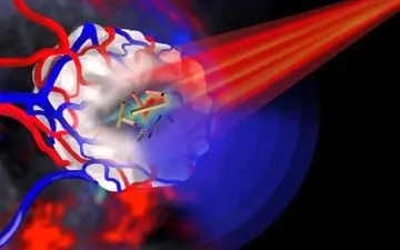 سخت ترین سرطانی که ایرانی ها می گیرند