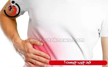 غذاهایی که قاتل کبد چرب است|9 مواد غذایی مفید برای کبد که باید بخورید