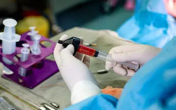 فواید تزریق چربی به واژن