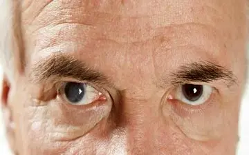 نزدیک بینی بهتر است یا دوربینی؟