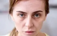 این علائم ساده را جدی بگیرید نشانه کم خونی است!/ این افراد جز گروه های پرخطرند
