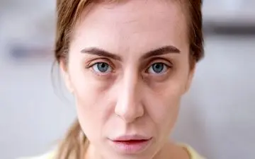 این علائم ساده را جدی بگیرید نشانه کم خونی است!/ این افراد جز گروه های پرخطرند