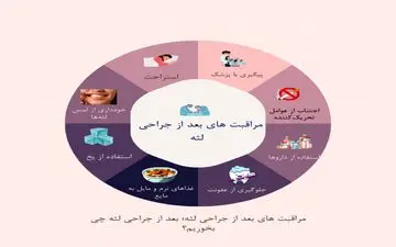 بعد از جراحی لثه چی بخوریم؟